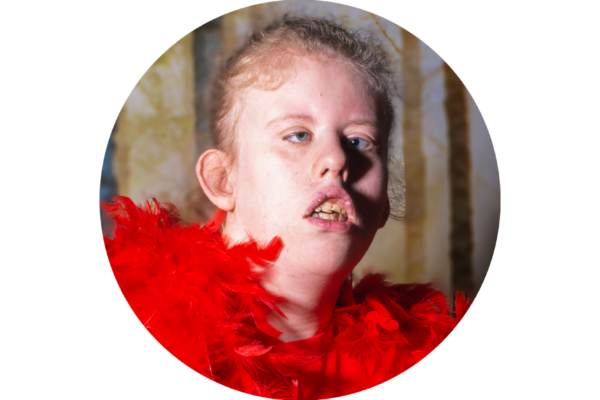 photo: A young woman is looking at the camera but her eyes are not looking in quite the same direction. She has pale curly ginger hair which is tied back from her face. Her lips are open but her teeth are together as if she is about to say something or make a noise. She is wearing a feather boa which is the brightest of bright reds.